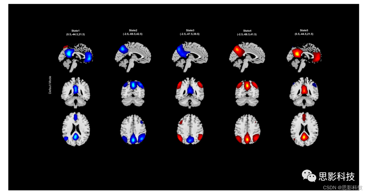 根据 fMRI 数据估计时变连接模式